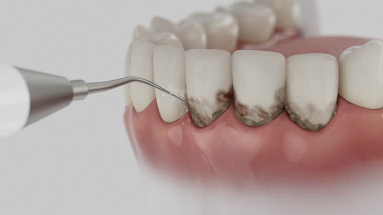 Trusted Teeth Cleaning And Checkup service in Harrison, WI - Dentist Open Now